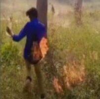A Student Got Burnt While Doing A Stunt After Being