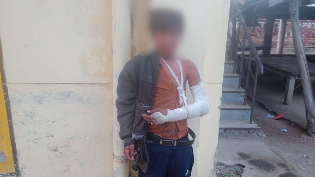 चोरी का जुर्म कबूल नहीं करने पर पुलिस ने तोड़ा पुलिस ने तोड़ा मासूम का हाथ.