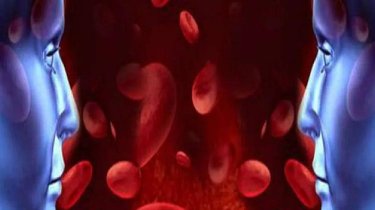 खून की इस बीमारी से बचने के लिए ना खाएं प्रतीकात्मक फोटो
