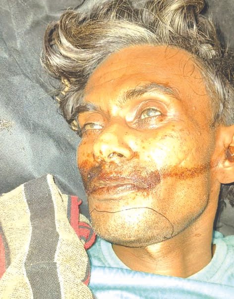 जलालगंज रेलवे स्टेशन पर अचेत मिले दिव्यांग की मौत, पहचान नहीं